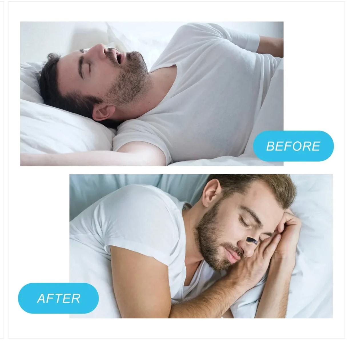 Magnetic Breathing Nasal Strip